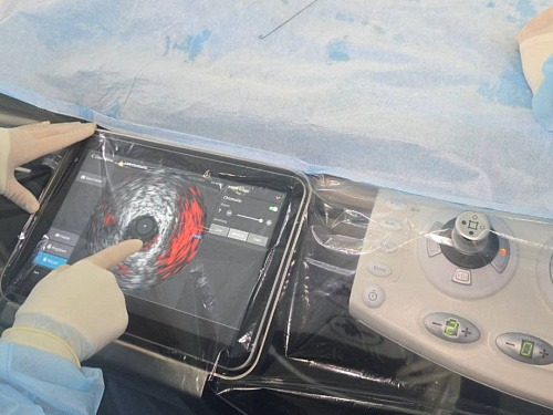 Увидеть невидимое: точность, которая спасает жизни